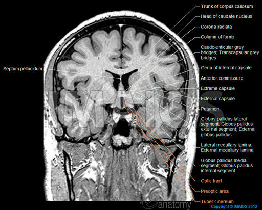 coronal-mr-brain-neuroanatomy-en_medical512