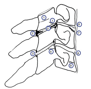 Posibles Lesiones LC