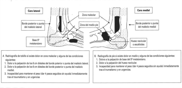 Reglas Ottawa Tobillo pie
