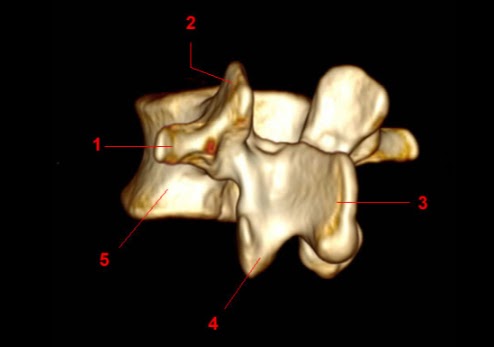 rochelle-vertebra-lumbar-oblicua-3d